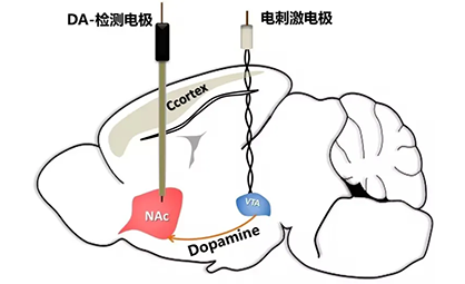 北脑盛会圆满落幕，展望科技新篇章！